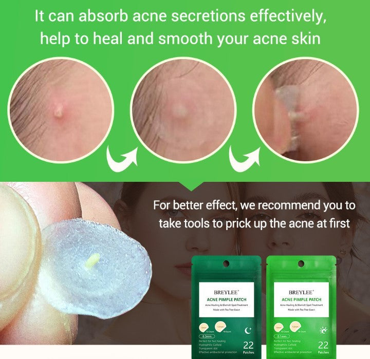 Ultra-Thin Tea Tree Acne Patch – Invisible Hydrocolloid Dots (30–50 pc)