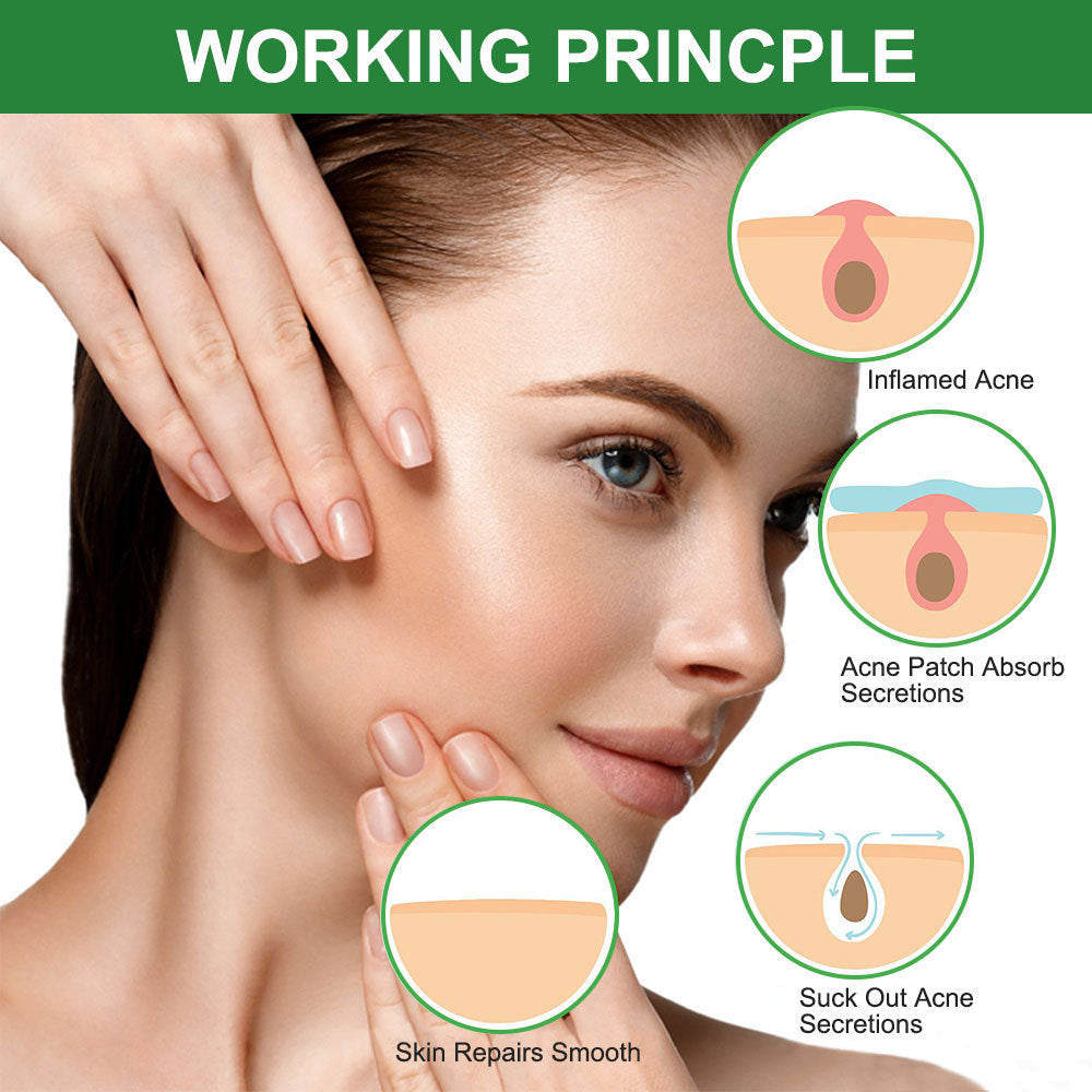 Waterproof Salicylic & Tea Oil Acne Patch – Invisible Dot