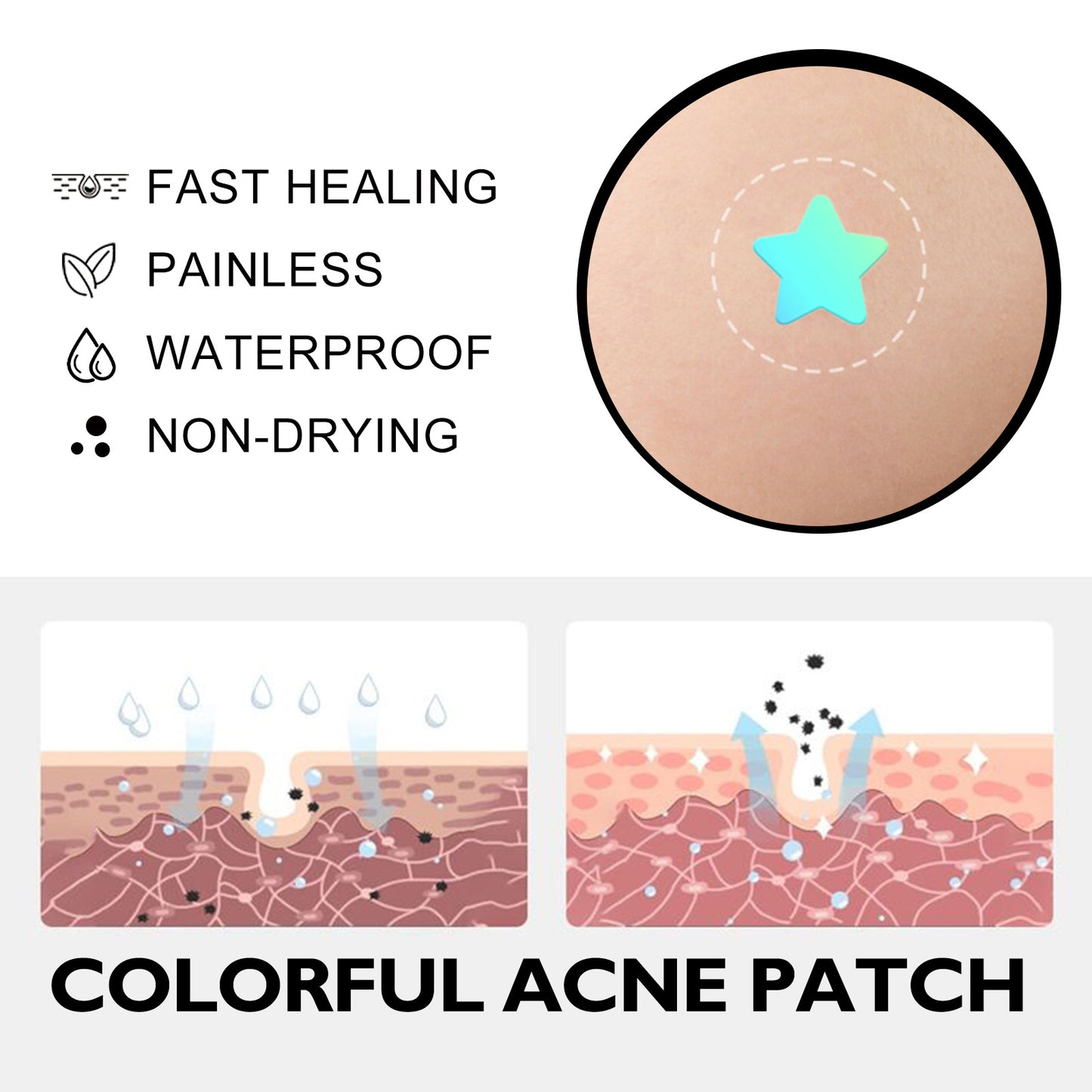 Hoygi Colorful Acne Hydrating Patches (100 pcs)