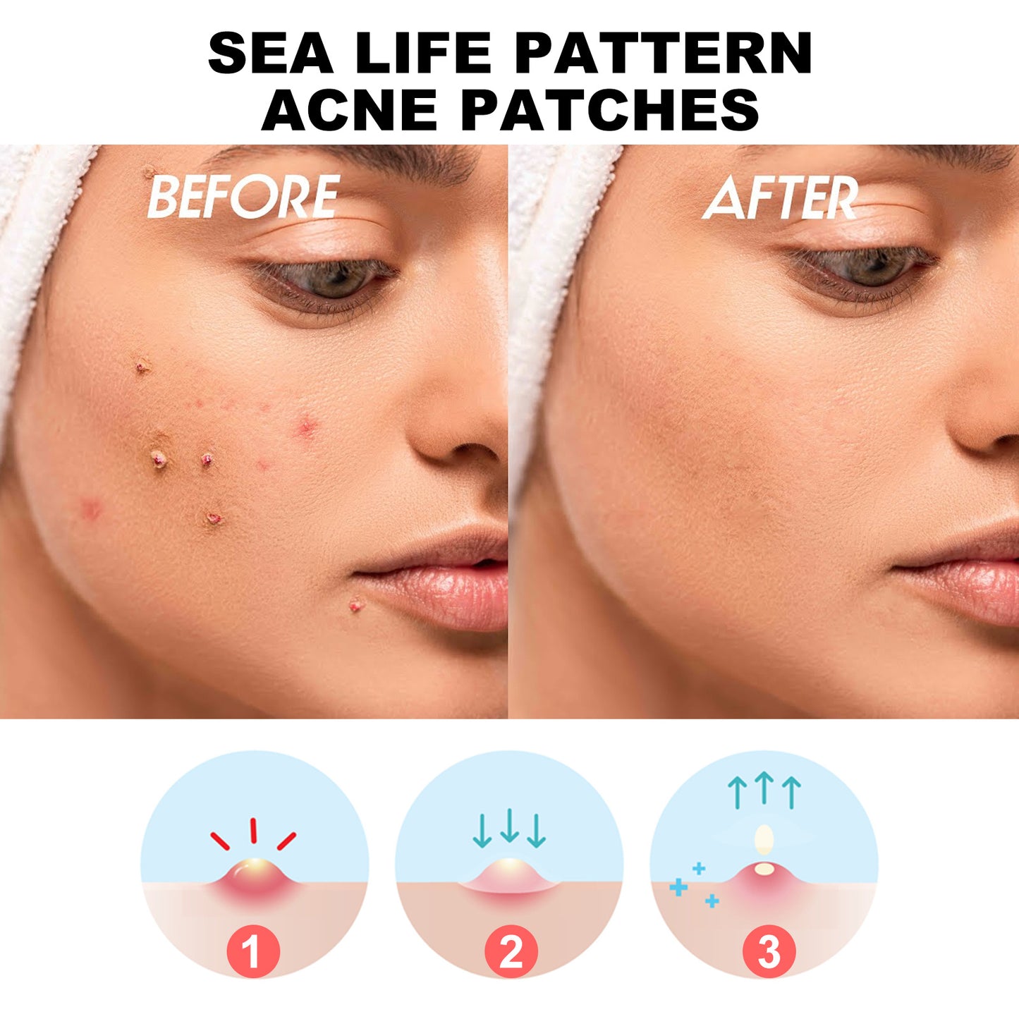 Hoygi Colorful Acne Hydrating Patches (100 pcs)